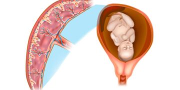 Signs of Placental Insufficiency and When to Seek Medical Attention