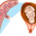Signs of Placental Insufficiency and When to Seek Medical Attention