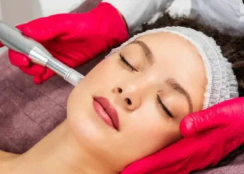 microneedling with exosomes