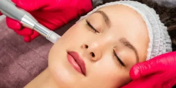 microneedling with exosomes