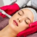 microneedling with exosomes