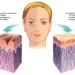 The Role of Collagen in Keeping Skin Firm and Youthful