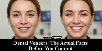 Dental veneers